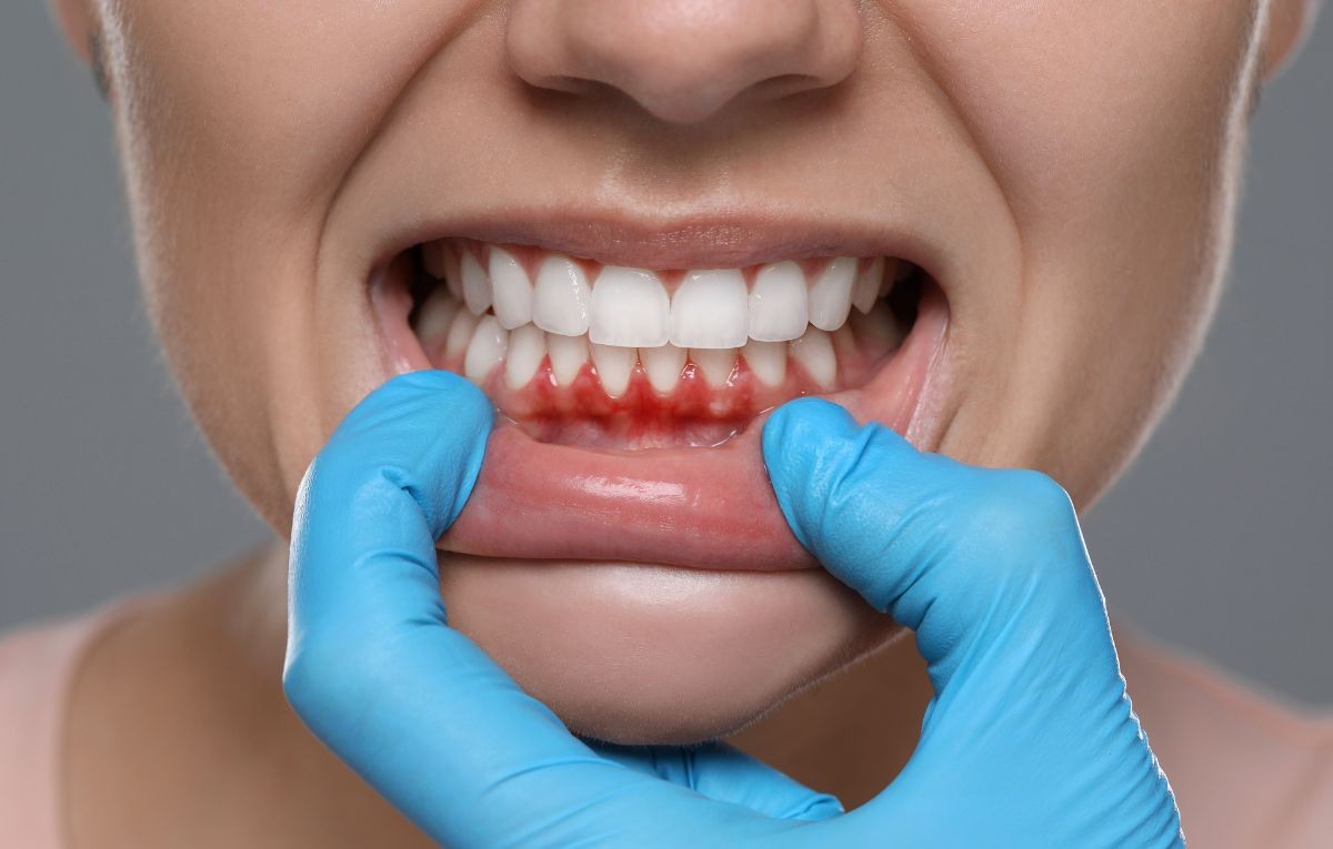 Problemas na gengiva? Descubra como a periodontia pode ser a solução que você precisa