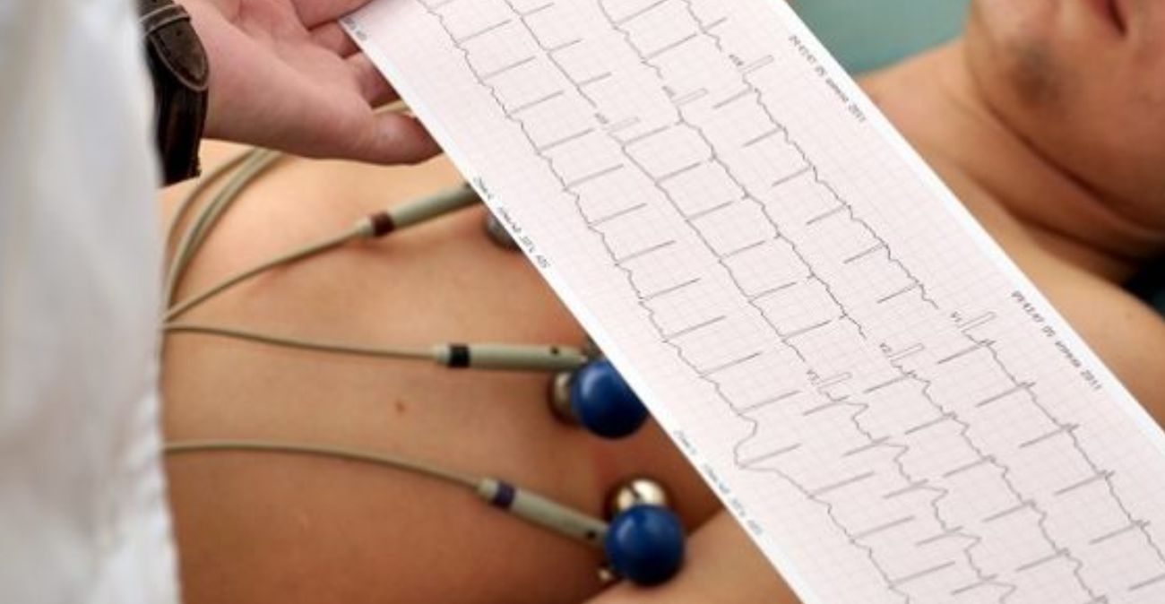 Você sabe para que serve o Eletrocardiograma?